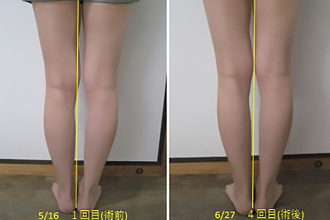 Before After②